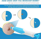 Auto Skin Tag Remover Kit for Face & Body Upgraded Fast and Easy Removal Pen with 40 Removal Bands & 10 Cleansing Wipes