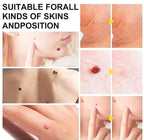 Auto Skin Tag Remover Kit for Face & Body Upgraded Fast and Easy Removal Pen with 40 Removal Bands & 10 Cleansing Wipes